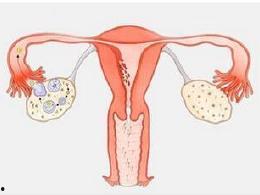 卵巢护理视频,视频揭秘卵巢护理全攻略